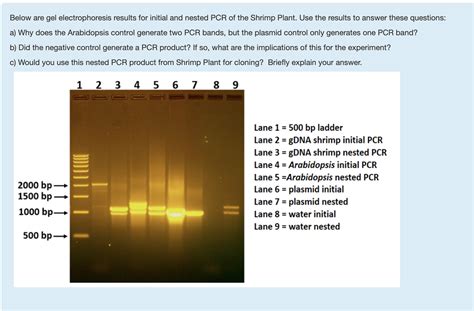 gel electrophoresis results